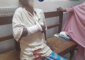 মির্জাপুরে প্রতিপক্ষের হামলায় হাড় ভাঙল দুই কৃষকের