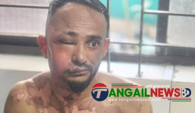 কালিহাতীতে বিএনপি নেতার উপর জিলাপী ভাজা গরম তেল নিক্ষেপ
