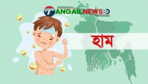 কুমুদিনী হাসপাতালে হামের উপসর্গে এক শিশুর মৃত্যু