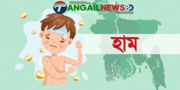 কুমুদিনী হাসপাতালে হামের উপসর্গে এক শিশুর মৃত্যু