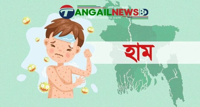 কুমুদিনী হাসপাতালে হামের উপসর্গে এক শিশুর মৃত্যু