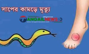 সখীপুরে সাপের কামড়ে শিশু অনিন্দিতার মৃত্যু
