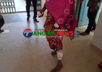নাগরপুরে পাগলা কুকুরের কামড়ে আহত ১৫ জন॥ ভ্যাকসিন সংকট হাসপাতালে