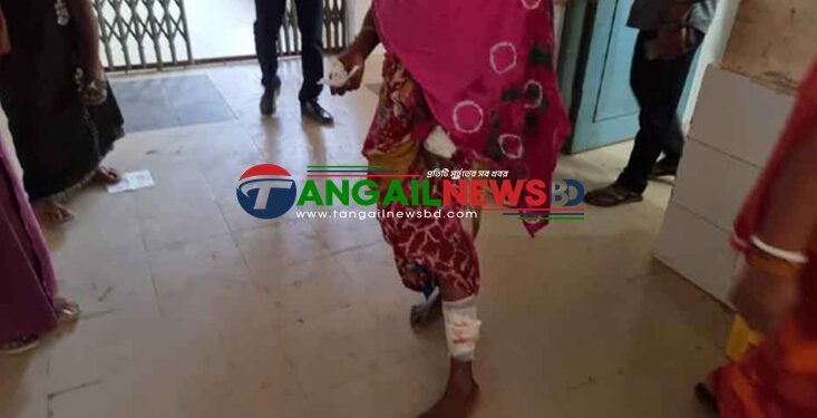 নাগরপুরে পাগলা কুকুরের কামড়ে আহত ১৫ জন॥ ভ্যাকসিন সংকট হাসপাতালে