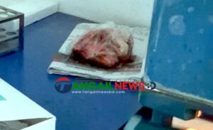 সখীপুরে ক্লিনিকের প্যাথলজির ফ্রিজে কাঁচা মাছ