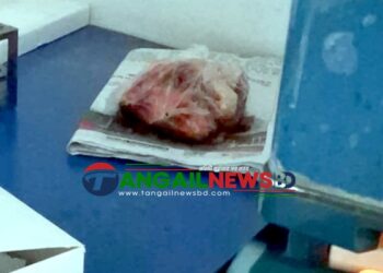 সখীপুরে ক্লিনিকের প্যাথলজির ফ্রিজে কাঁচা মাছ