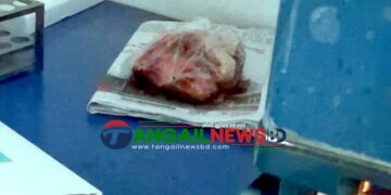 সখীপুরে ক্লিনিকের প্যাথলজির ফ্রিজে কাঁচা মাছ