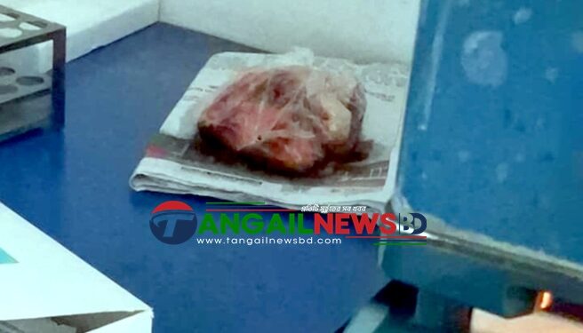 সখীপুরে ক্লিনিকের প্যাথলজির ফ্রিজে কাঁচা মাছ