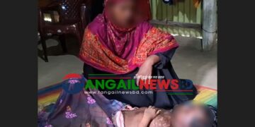 সখীপুরে বিরল রোগে আক্রান্ত হয়ে স্কুলছাত্রীর মৃত্যু