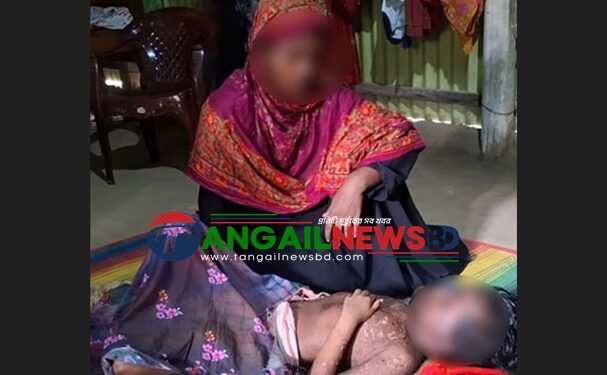 সখীপুরে বিরল রোগে আক্রান্ত হয়ে স্কুলছাত্রীর মৃত্যু