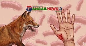 গোপালপুরে পাগলা শেয়ালের হামলায় নারীসহ আহত ৩ জন