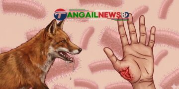 গোপালপুরে পাগলা শেয়ালের হামলায় নারীসহ আহত ৩ জন